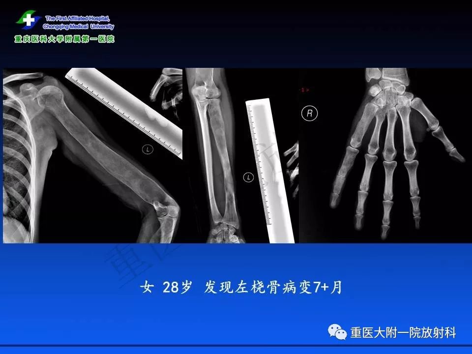 关于拉克拉女王的惊人真相